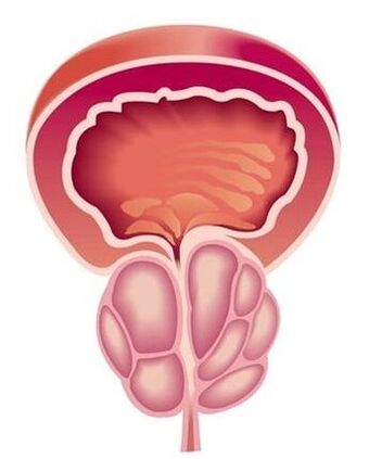 Simptomele prostatitei la bărbați