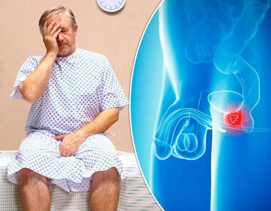 Un bărbat cu prostatită este supus diagnosticului de boală